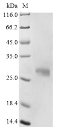 SDS-PAGE