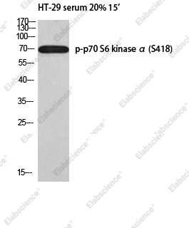 Вестерн-блоттинг, Phospho-p70 S6 kinase alpha (Ser418), клетки HT-29