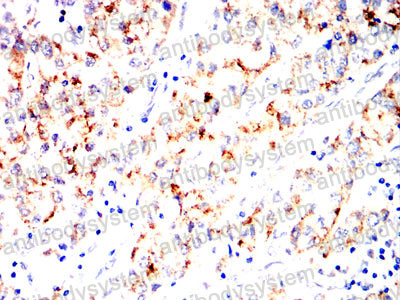 Валидация AntibodySystem RHG08906 (2836)