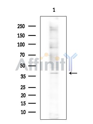 Валидация Affinity DF15257 - 11539