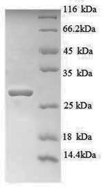 SDS-PAGE