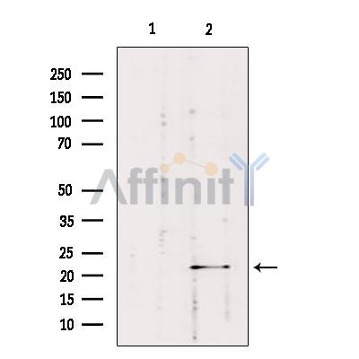 Валидация Affinity DF9818 - 22702