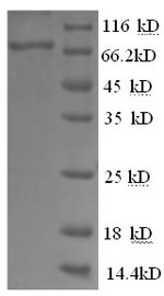 SDS-PAGE