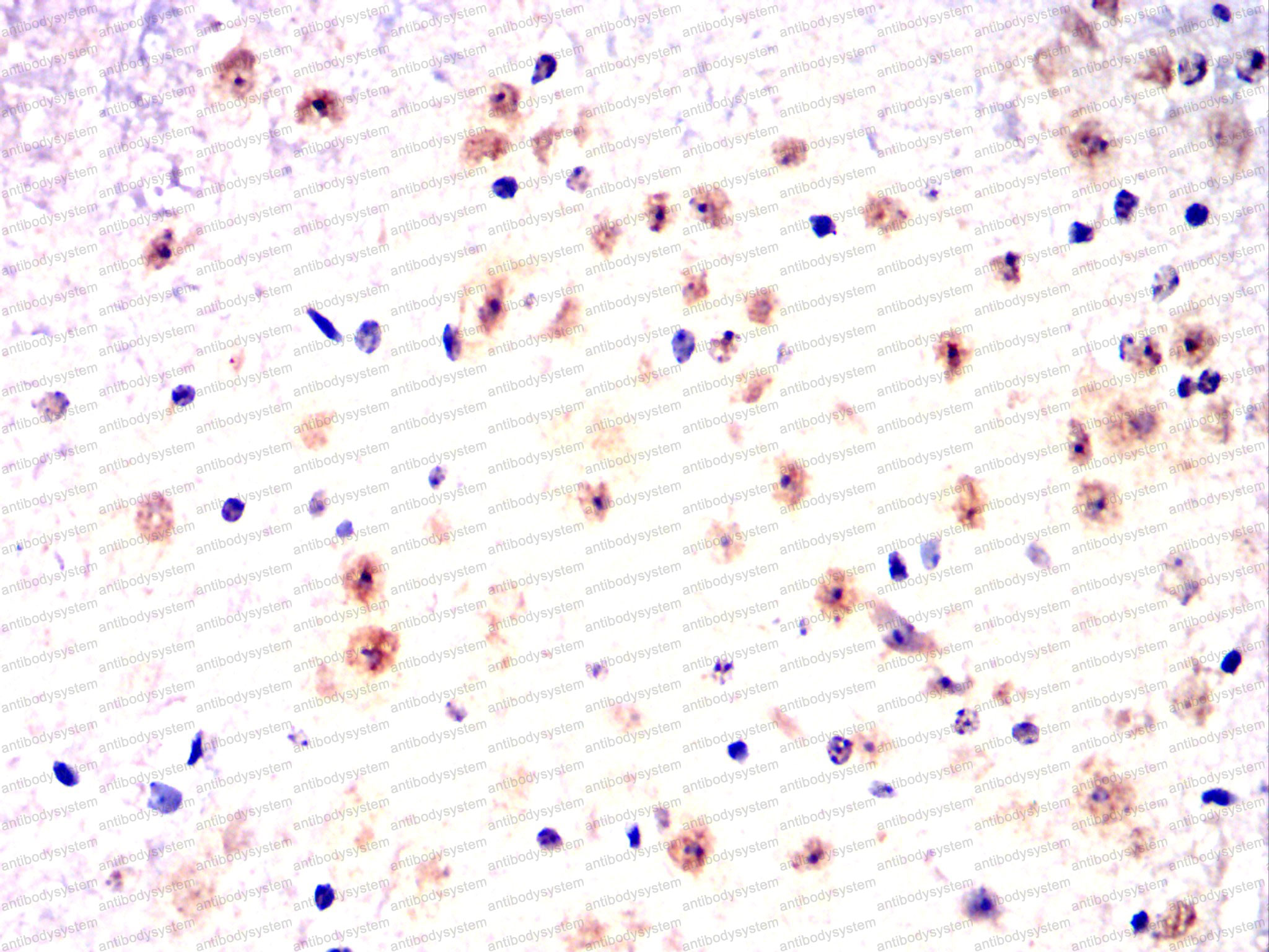 Валидация AntibodySystem RHJ44804 (3420)