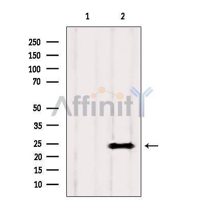 Валидация Affinity DF8571 - 20472
