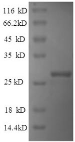 SDS-PAGE