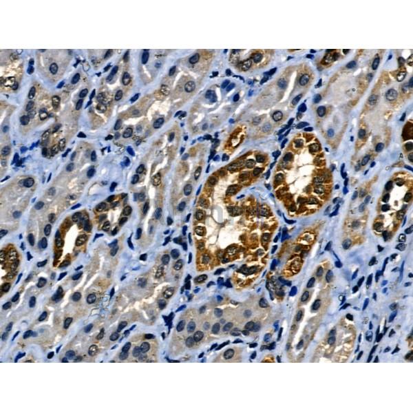 Валидация Affinity AF5142 - 2536