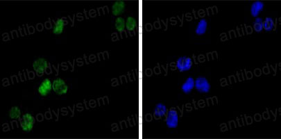 Валидация IF - AntibodySystem RHD14403