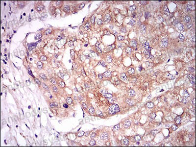 Валидация AntibodySystem RHE13402