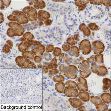 Валидация AntibodySystem RHN56001