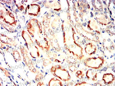 Валидация AntibodySystem RHC44503