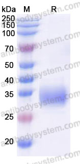 AHJ69201, SDS-PAGE
