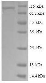SDS-PAGE