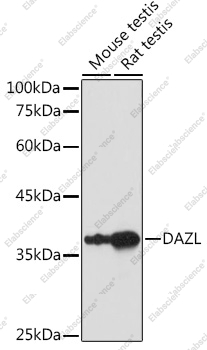 Вестерн-блоттинг, DAZL, различные клеточные линии