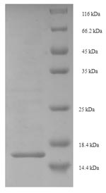 SDS-PAGE