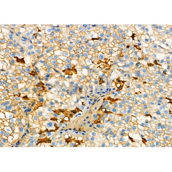 Валидация Affinity DF8629 - 20571