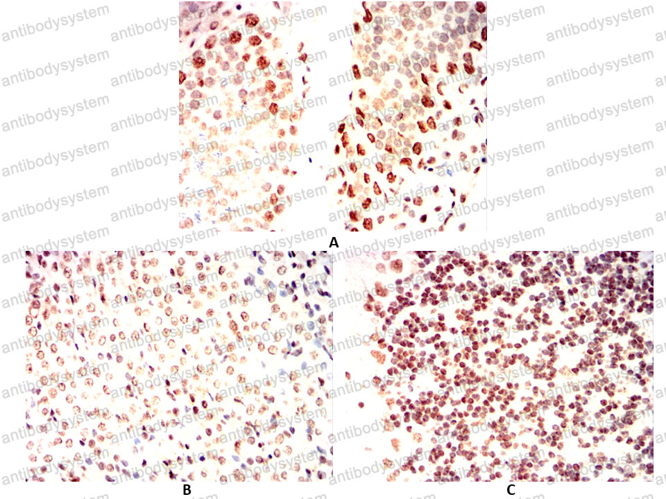 Валидация AntibodySystem RHC03209 (562)