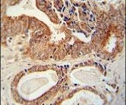 Валидация AssayVector ARM1830(2392)