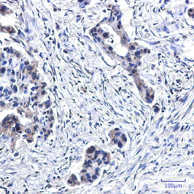 Валидация AntibodySystem RHA94904