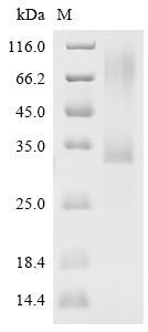SDS-PAGE
