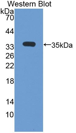 55595