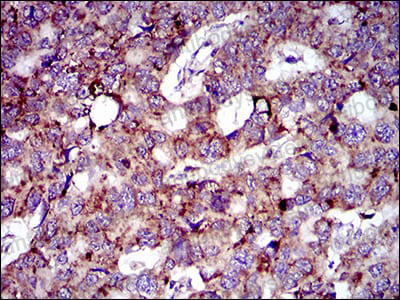 Валидация AntibodySystem RHP00501