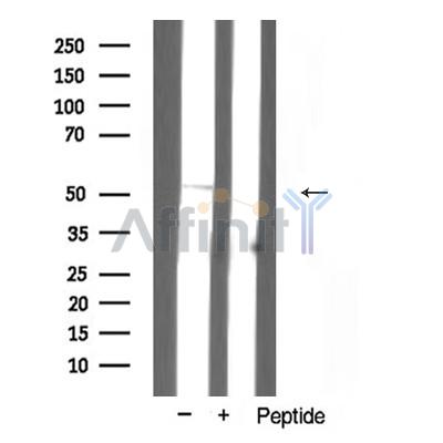 Валидация Affinity AF5370 - 2987