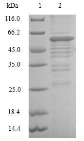 SDS-PAGE