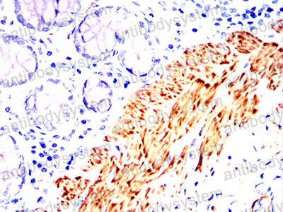 Валидация AntibodySystem RHF52709