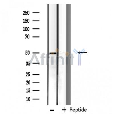 Валидация Affinity DF3587 - 14546
