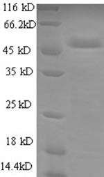 SDS-PAGE