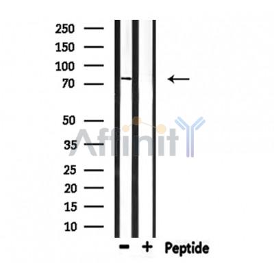 Валидация Affinity DF8539 - 20420