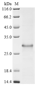 SDS-PAGE