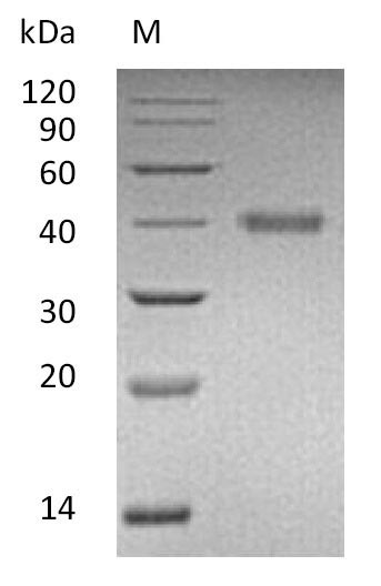 SDS-PAGE