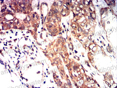 Валидация AntibodySystem RHD46503