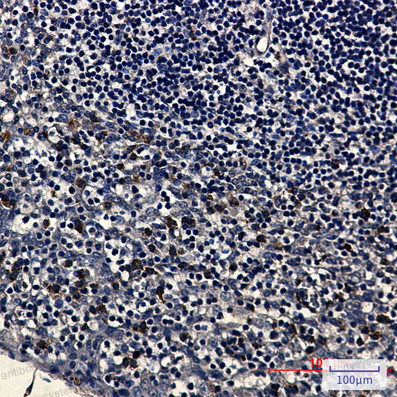 Валидация AntibodySystem RHD36906