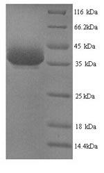 SDS-PAGE