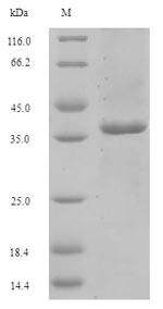 SDS-PAGE