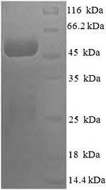 SDS-PAGE