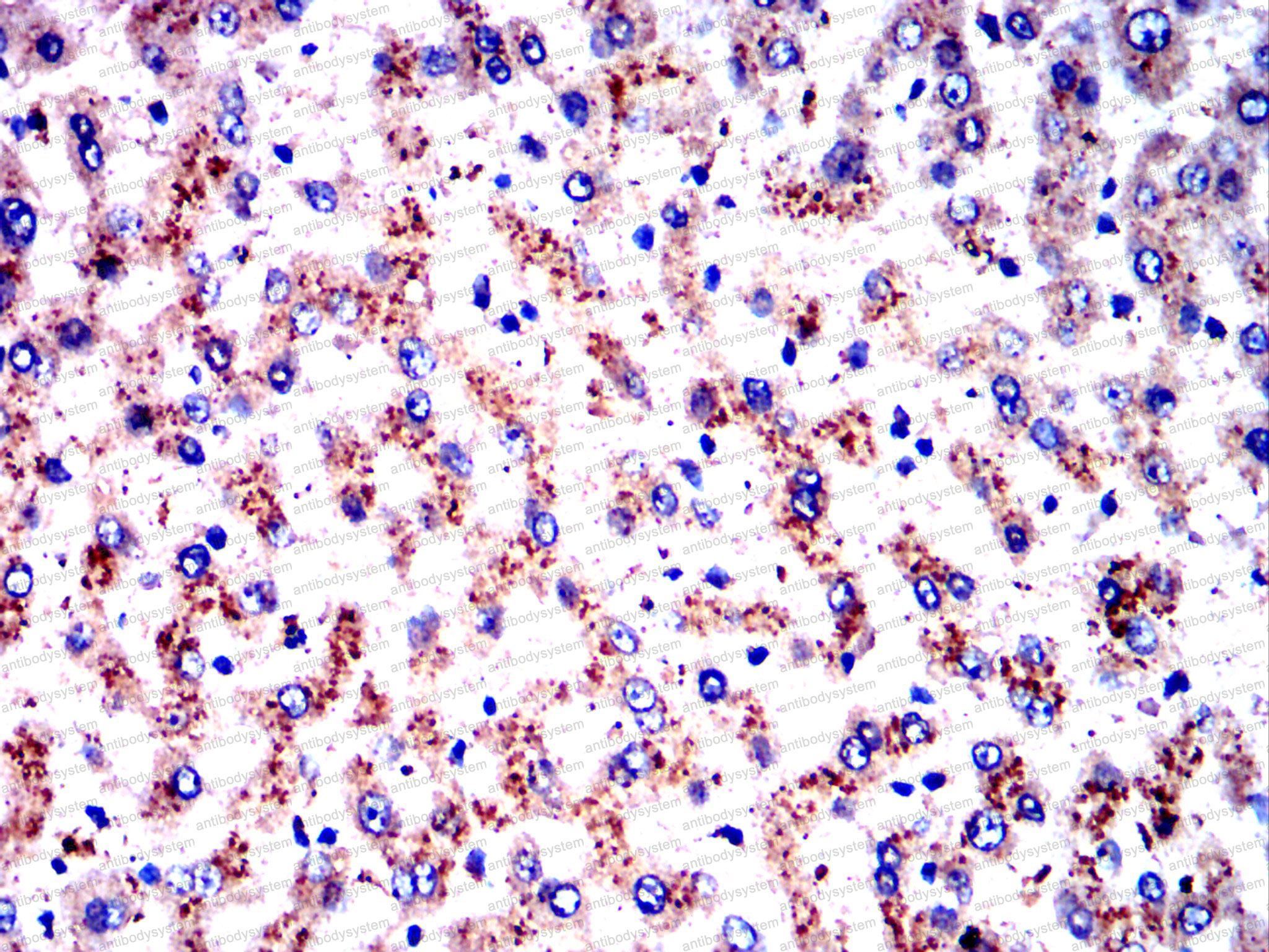 Валидация AntibodySystem RHC15806 (682)