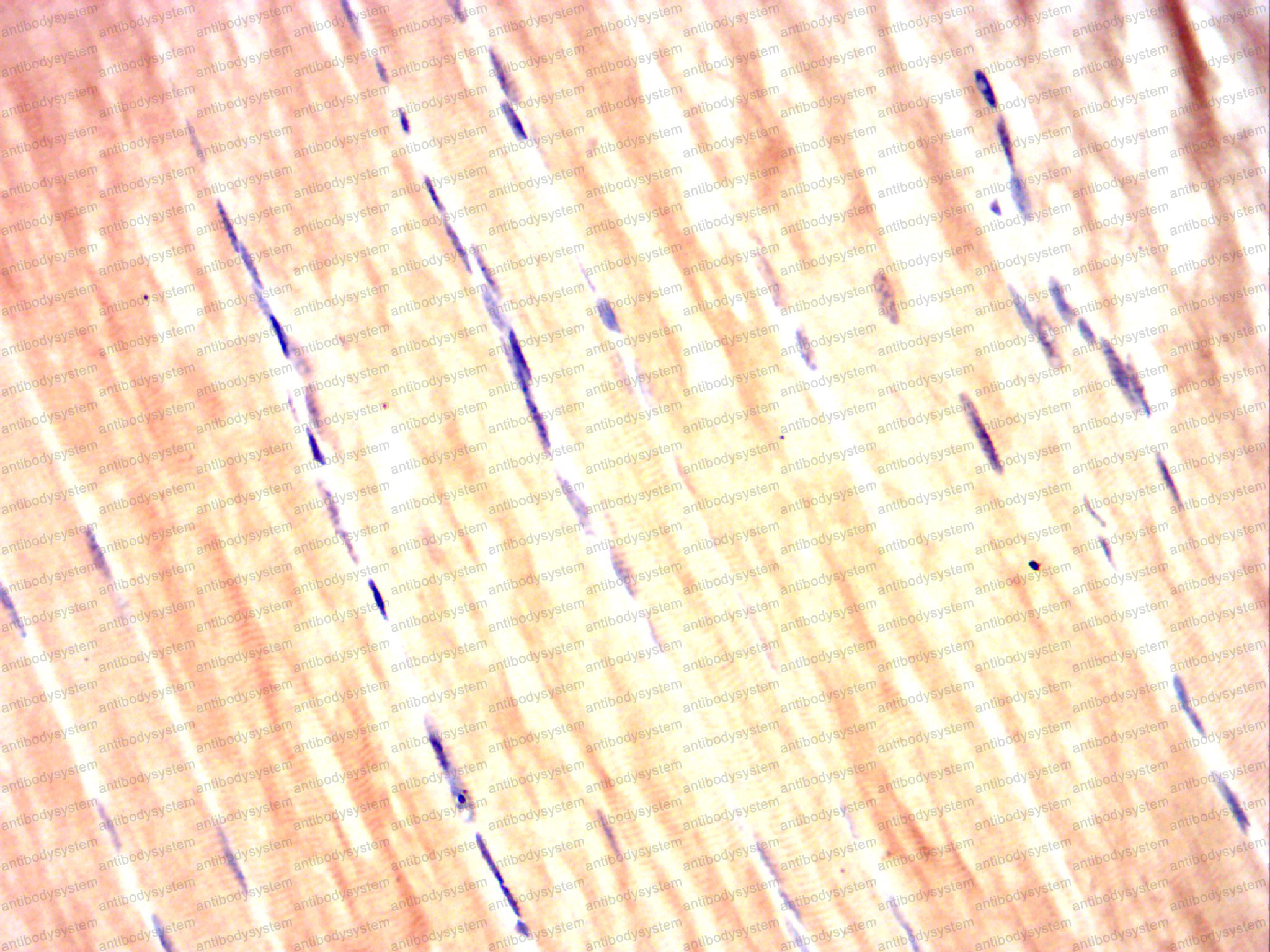 Валидация AntibodySystem RHH38602