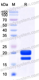 AHD85406, SDS-PAGE