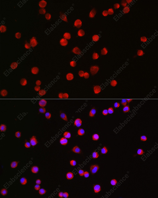 Иммунофлуоресценция, BSN, клетки Neuro-2a