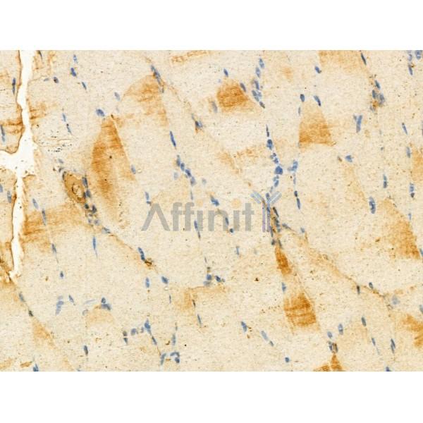 Валидация Affinity DF13081 - 7957