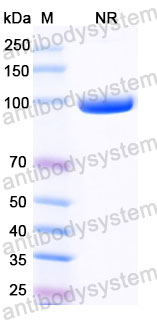 Валидация SDS-PAGE - AntibodySystem RVV09904