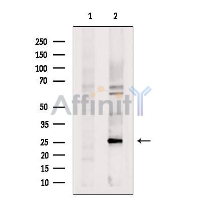 Валидация Affinity DF12445 - 6972
