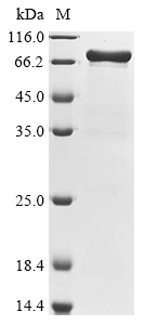 SDS-PAGE