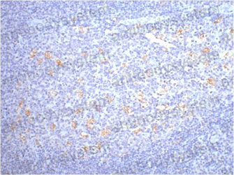 Валидация AntibodySystem RHE04901