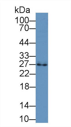 12580