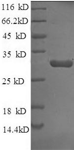 SDS-PAGE